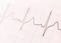 Heartbeat line