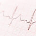 Heartbeat line