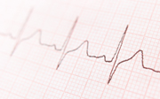 Heartbeat line