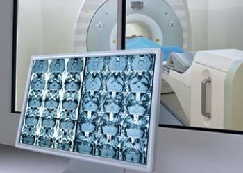 Medical scan monitor