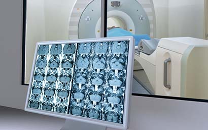 Medical scan monitor