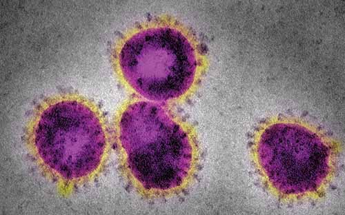 Coronavirus